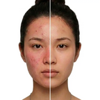 Glowteq Red Light Therapy Mask