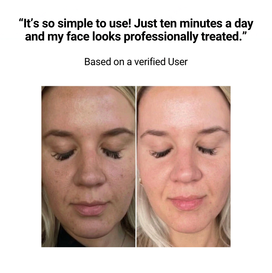 Glowteq Red Light Therapy Mask